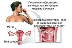 Вагиноз - причина выделений