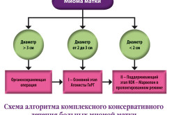 Алгоритм лечения миомы матки