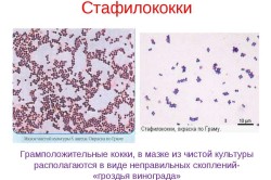 Стафилококки под микроскопом