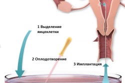 Принцип ЭКО