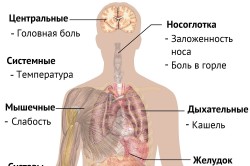 Грипп - причина маточного кровотечения