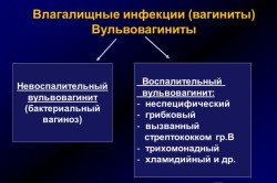 Виды вульвовагинита