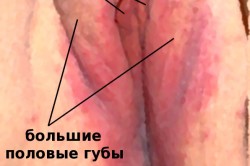 Вульвит